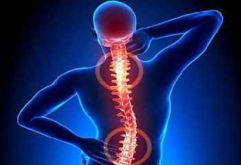 নিউরো স্পাইন সোসাইটির তথ্য/ চট্টগ্রামে ৩০-৪৫% মেরুদণ্ডের রোগী আছে