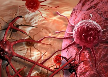 চট্টগ্রামে ক্যান্সার চিকিৎসার যত উদ্যোগ